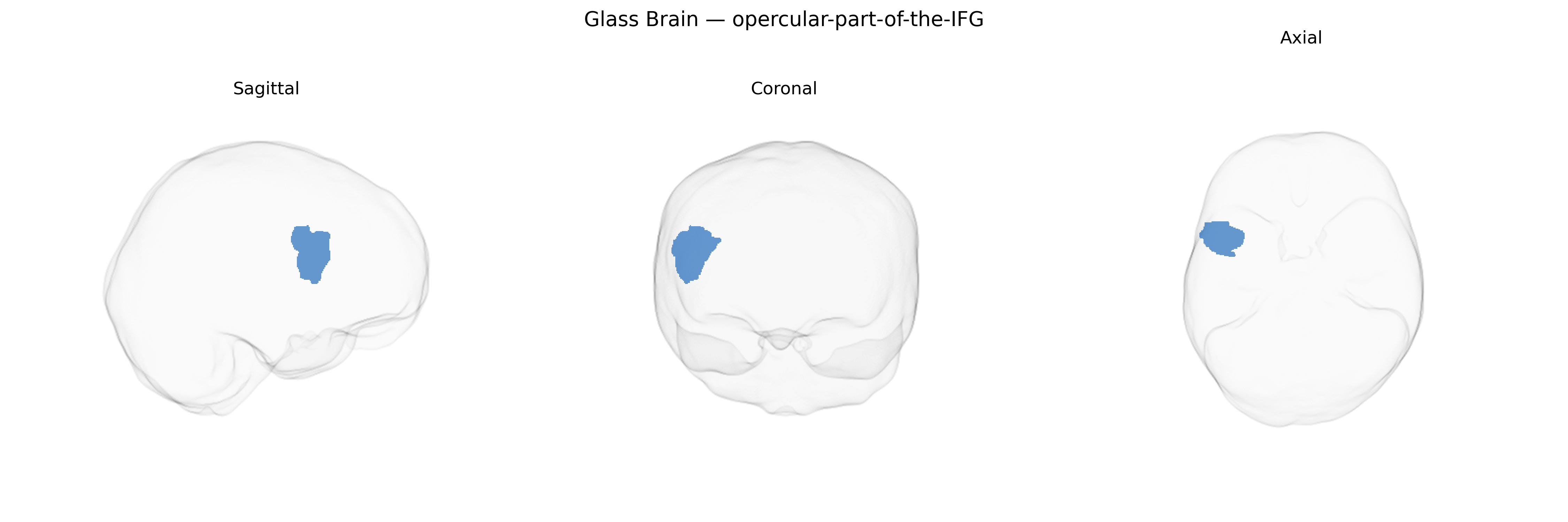 Triplanar Ghost Brain