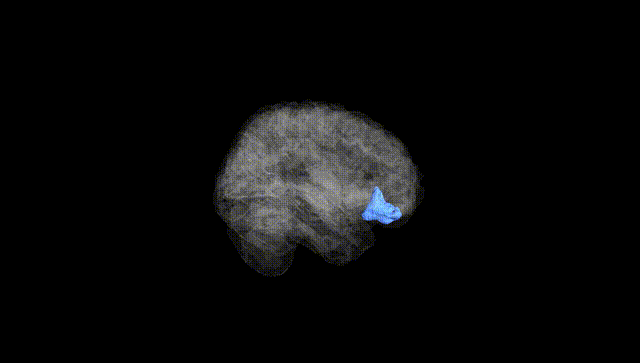 Full Brain Black