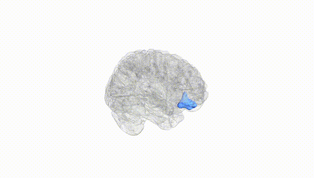 Full Brain White