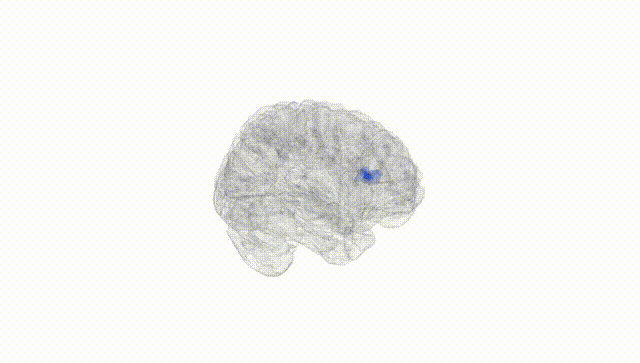 Full Brain White