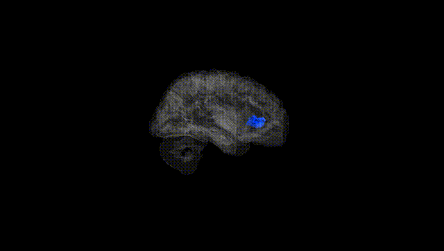 Hemisphere Black