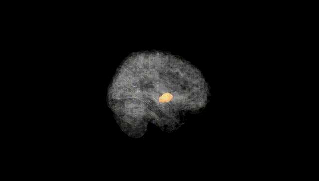 Full Brain Black
