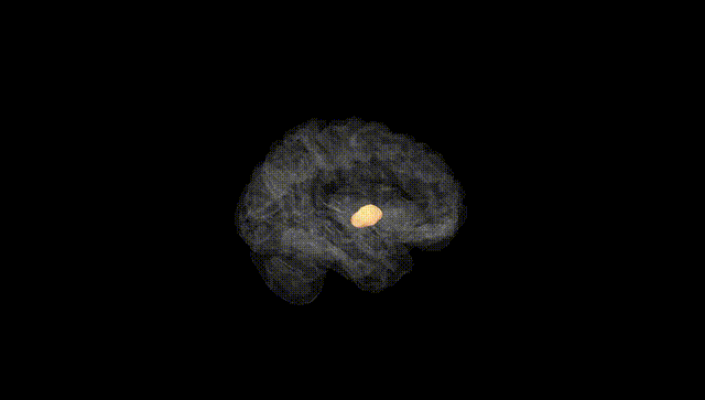 Hemisphere Black