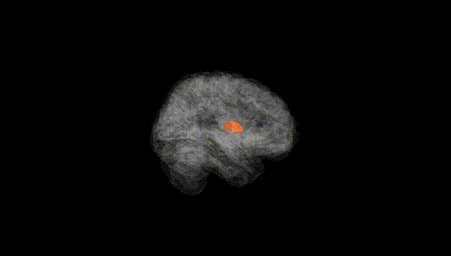 Full Brain Black