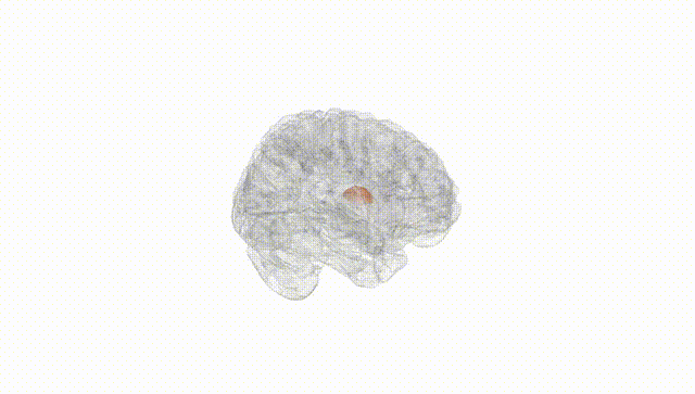 Full Brain White