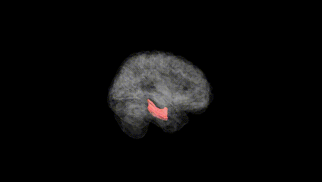 Full Brain Black