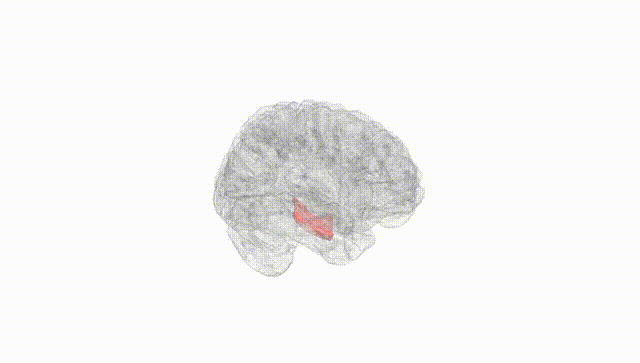 Full Brain White