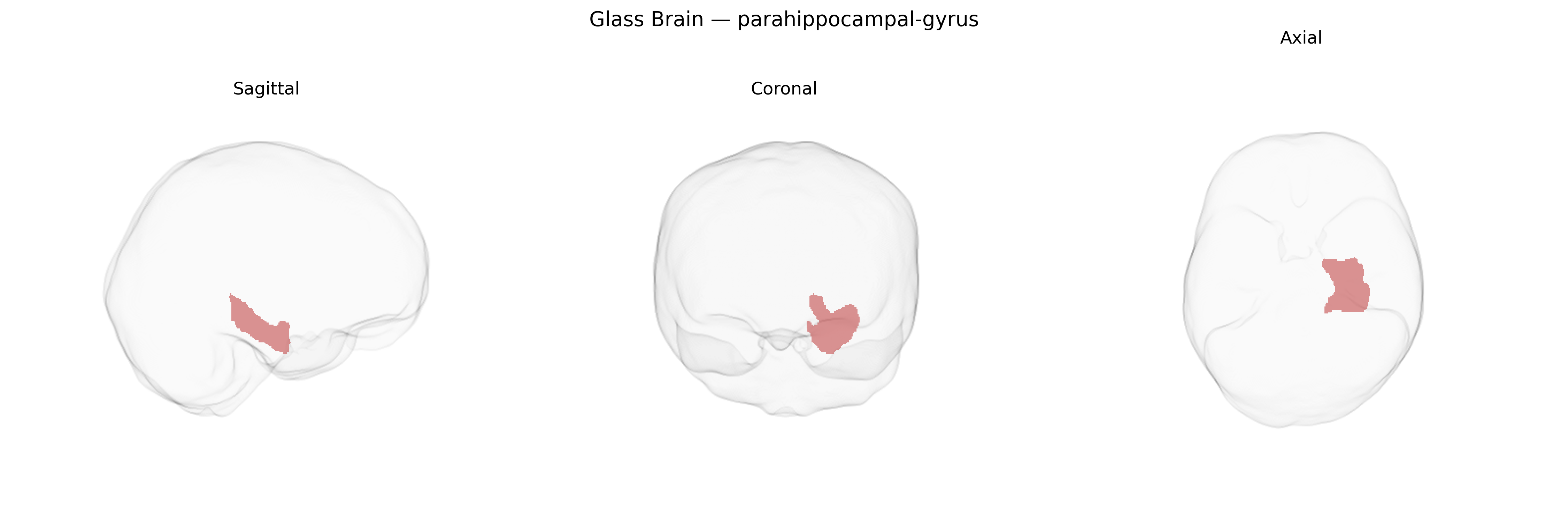Triplanar Ghost Brain