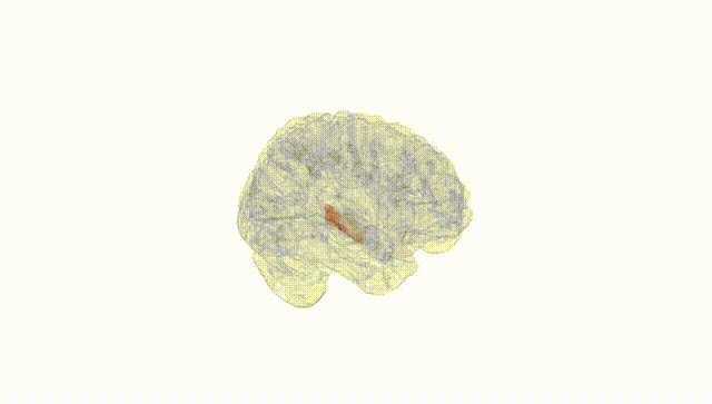 Full Brain White