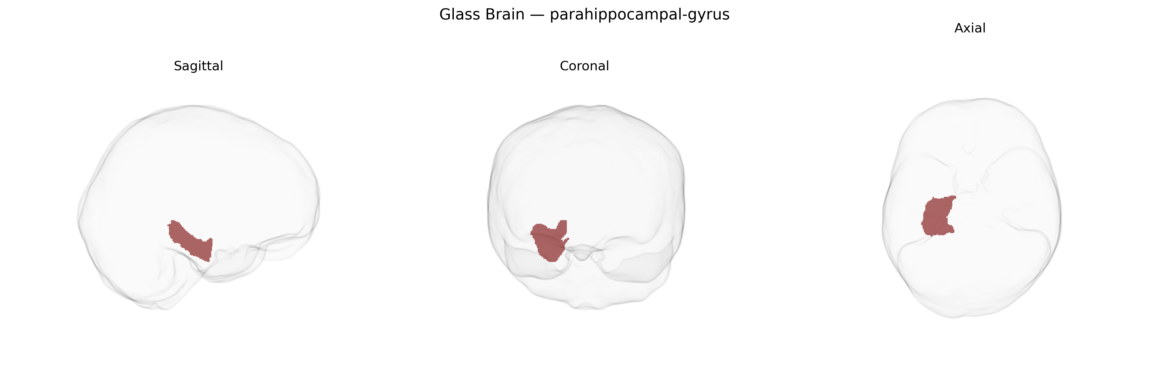 Triplanar Ghost Brain