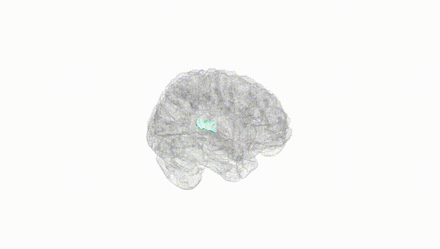 Full Brain White