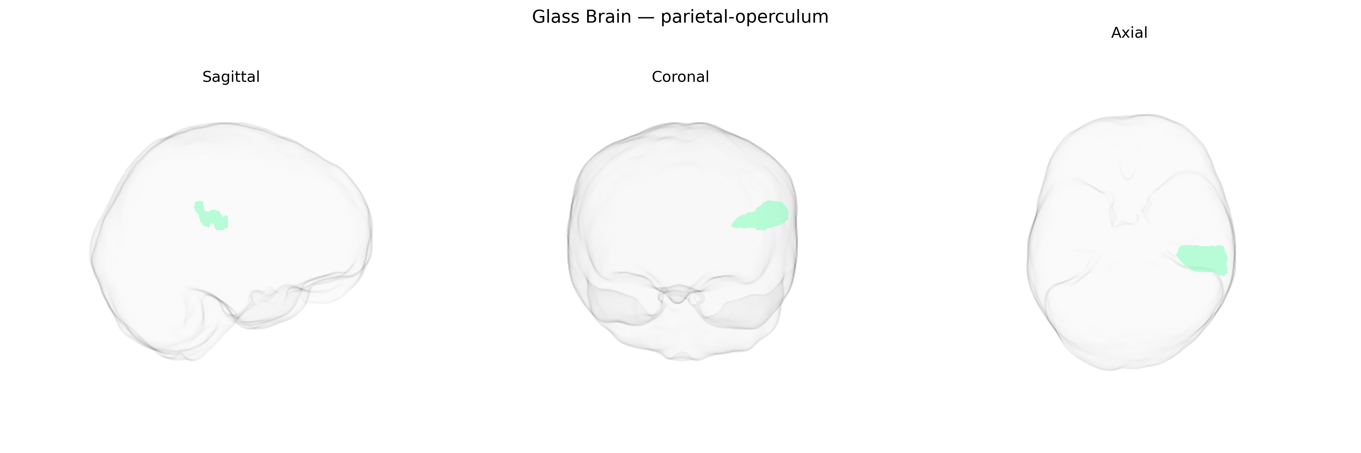 Triplanar Ghost Brain