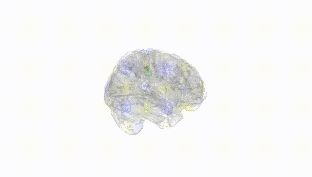 Full Brain White