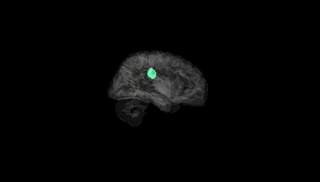 Hemisphere Black