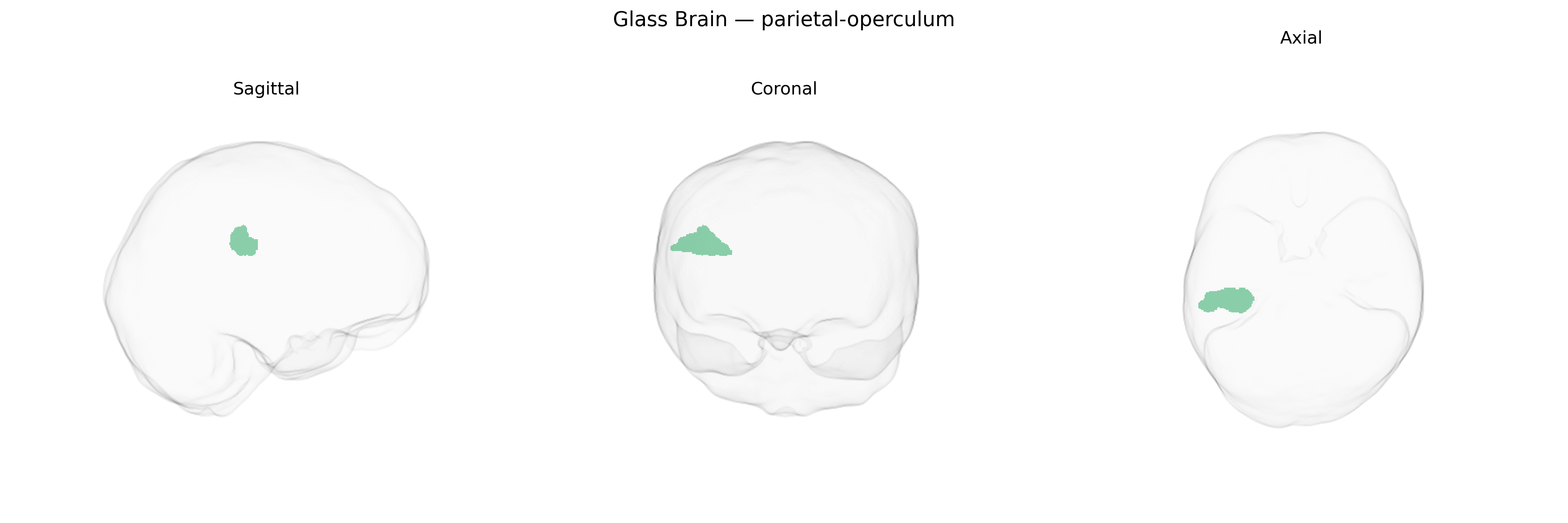 Triplanar Ghost Brain