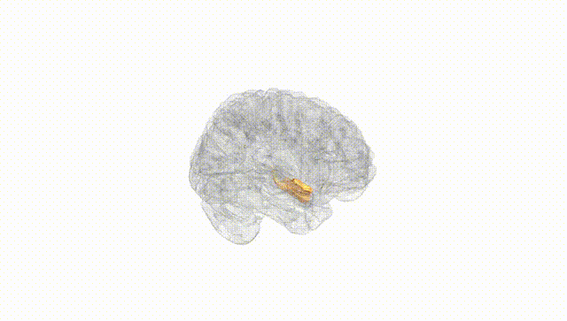 Full Brain White