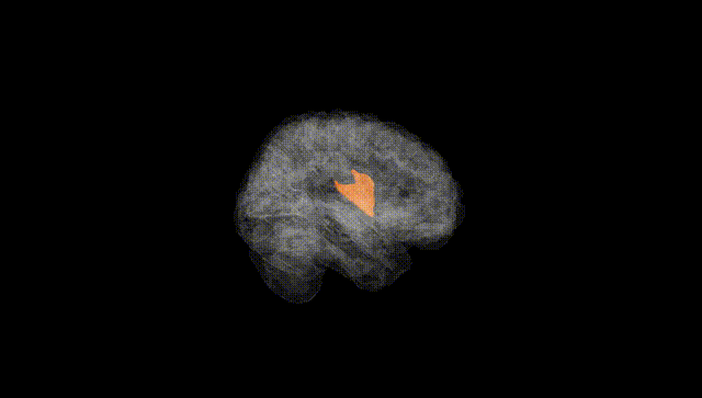 Full Brain Black
