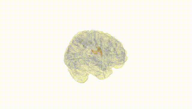 Full Brain White