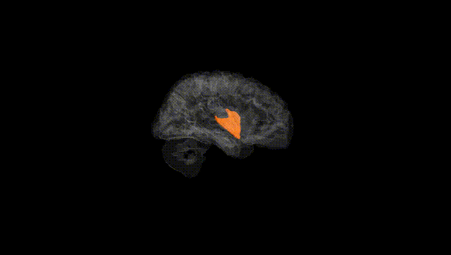 Hemisphere Black