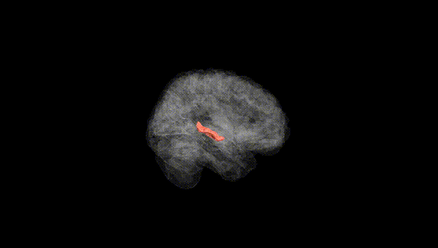 Full Brain Black
