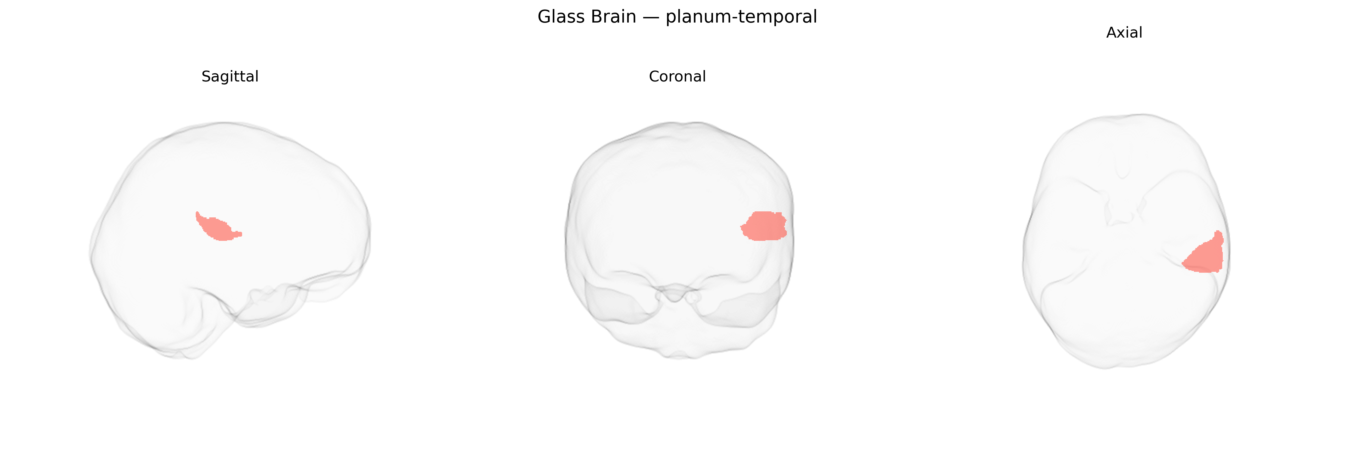Triplanar Ghost Brain