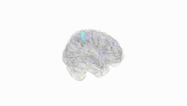 Full Brain White