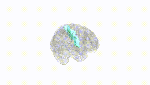 Full Brain White