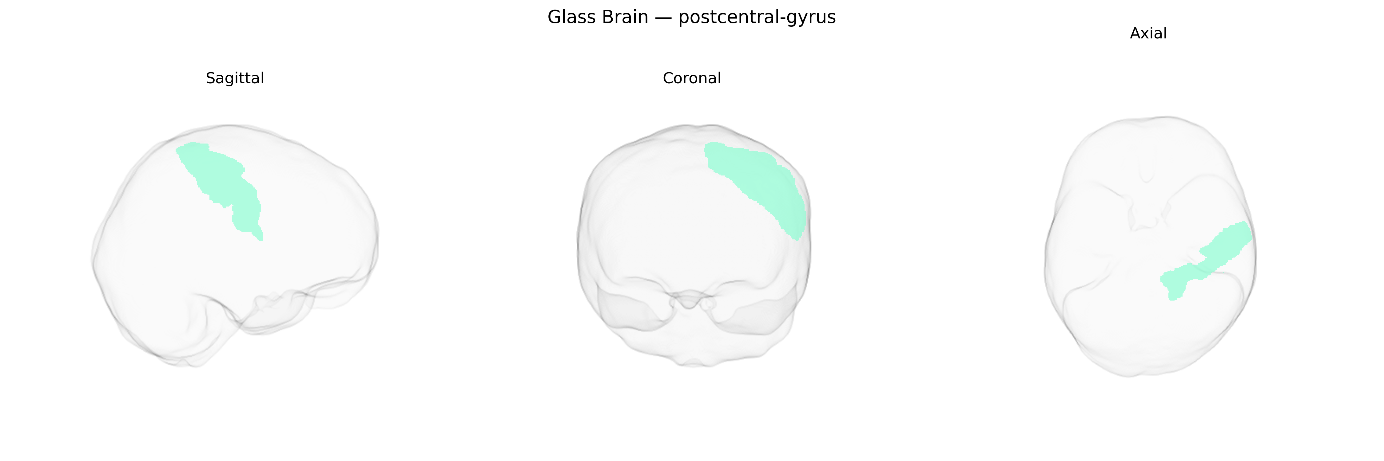 Triplanar Ghost Brain
