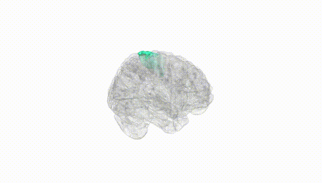 Full Brain White
