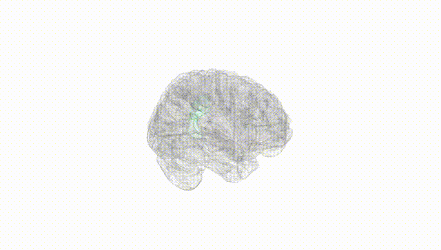 Full Brain White