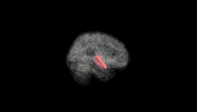 Full Brain Black