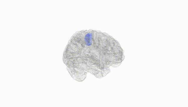 Full Brain White