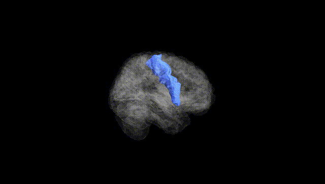 Full Brain Black