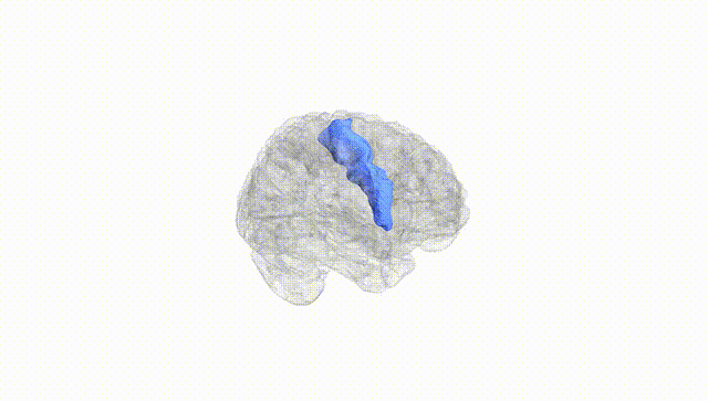 Full Brain White