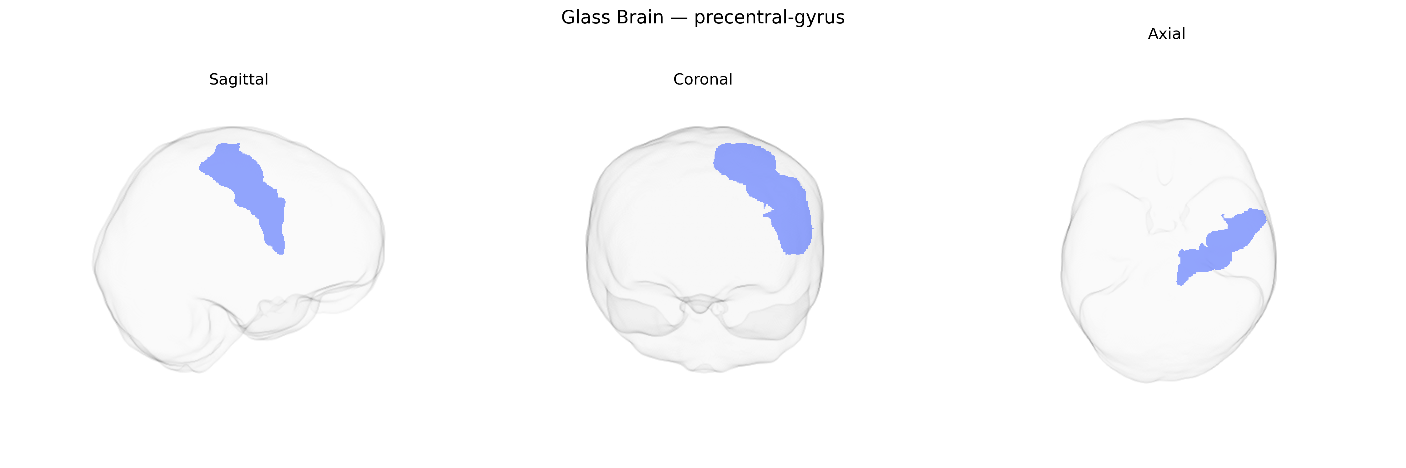 Triplanar Ghost Brain
