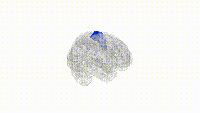 Full Brain White