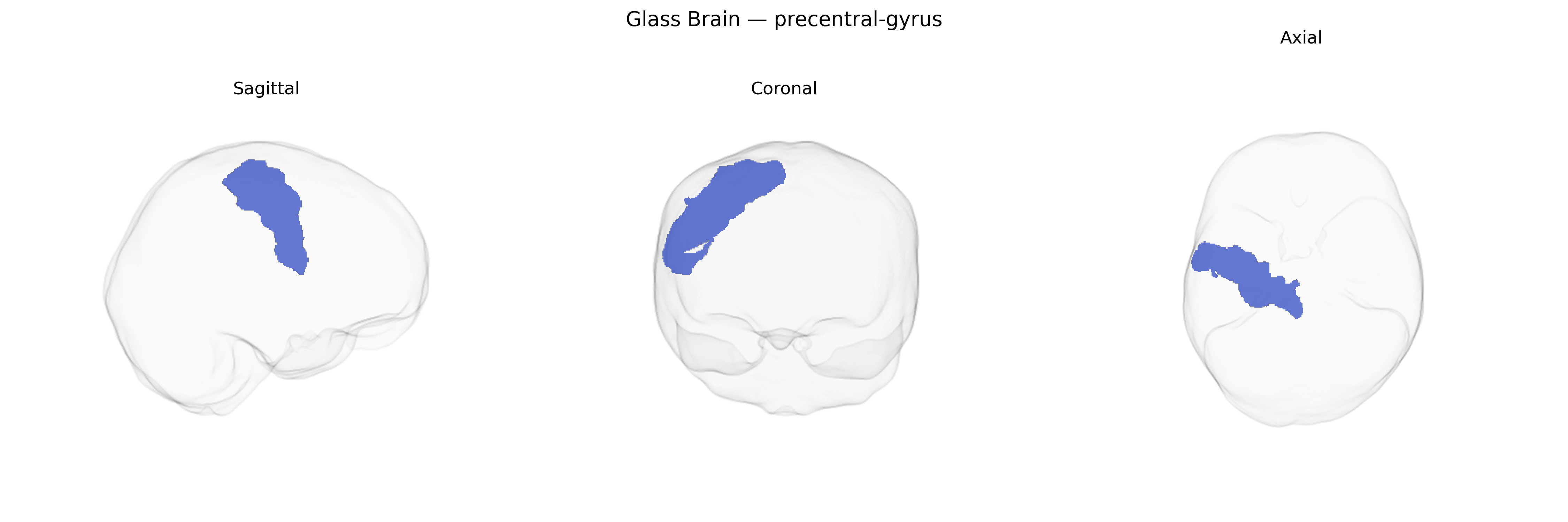 Triplanar Ghost Brain