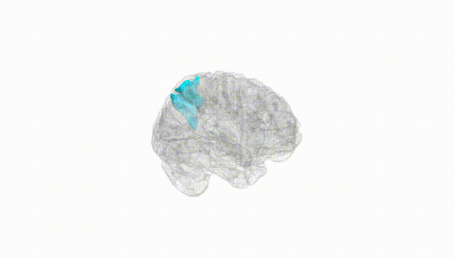 Full Brain White