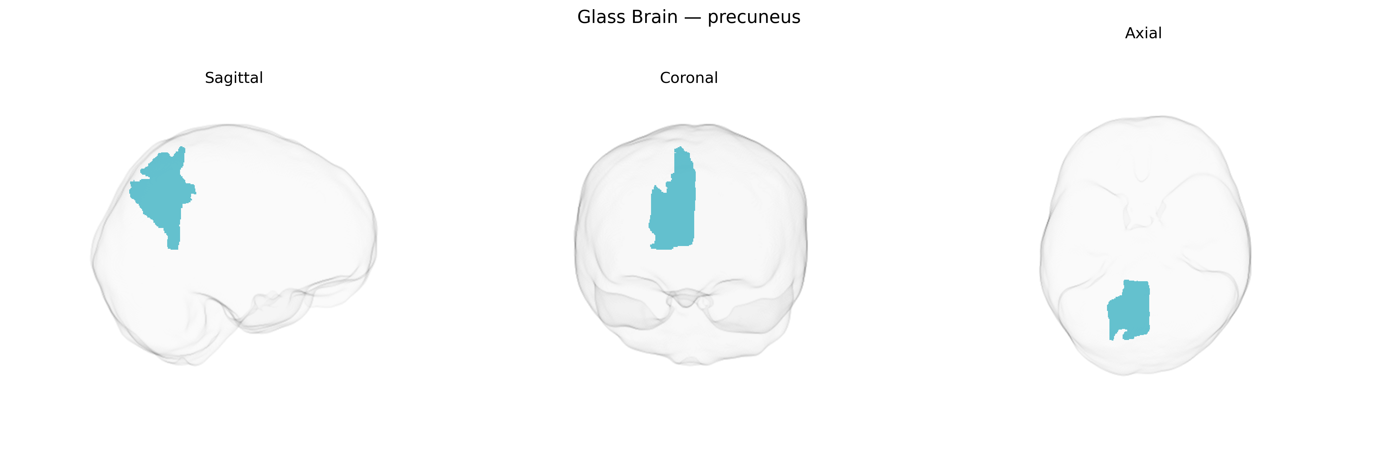 Triplanar Ghost Brain