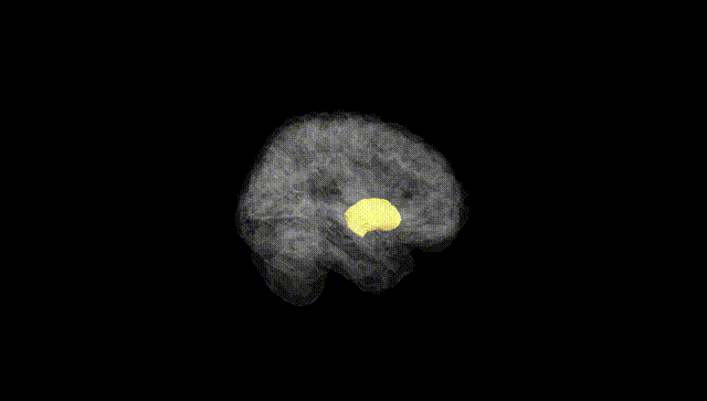 Full Brain Black