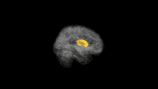 Full Brain Black