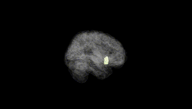 Full Brain Black