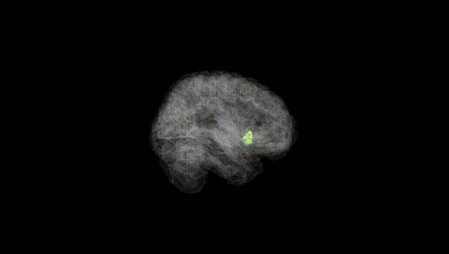 Full Brain Black