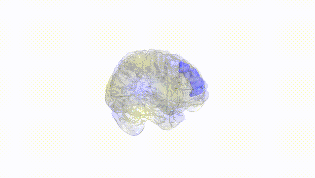 Full Brain White