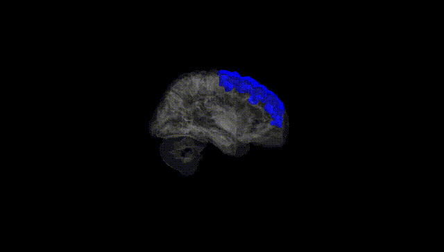Hemisphere Black