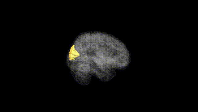 Full Brain Black