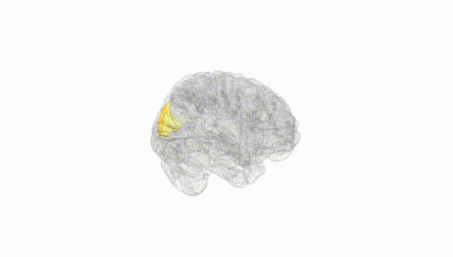 Full Brain White