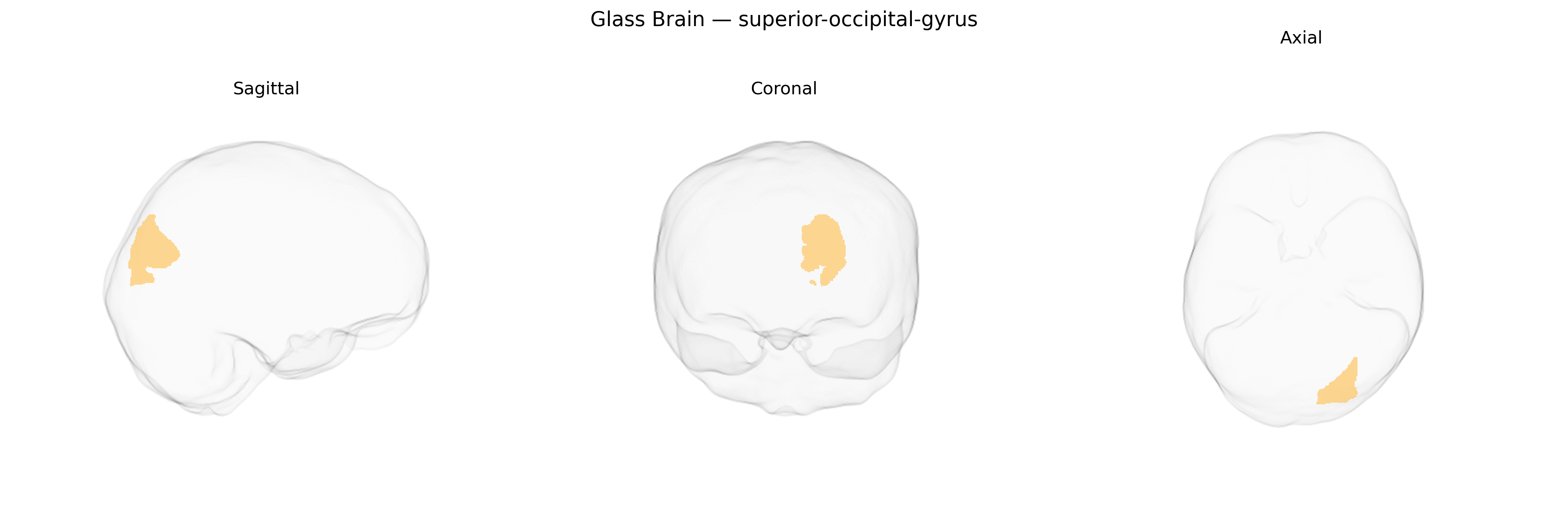 Triplanar Ghost Brain