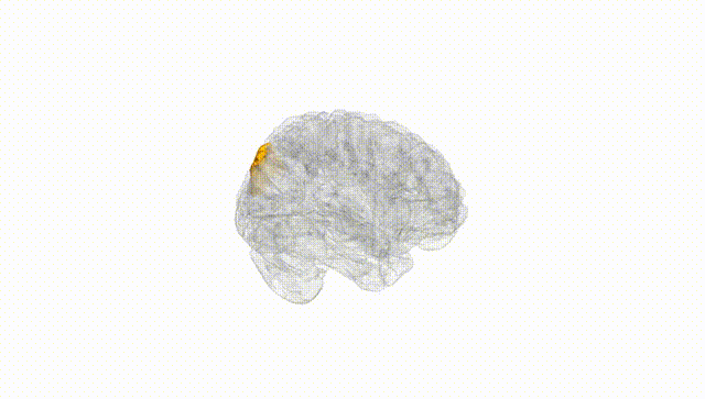 Full Brain White