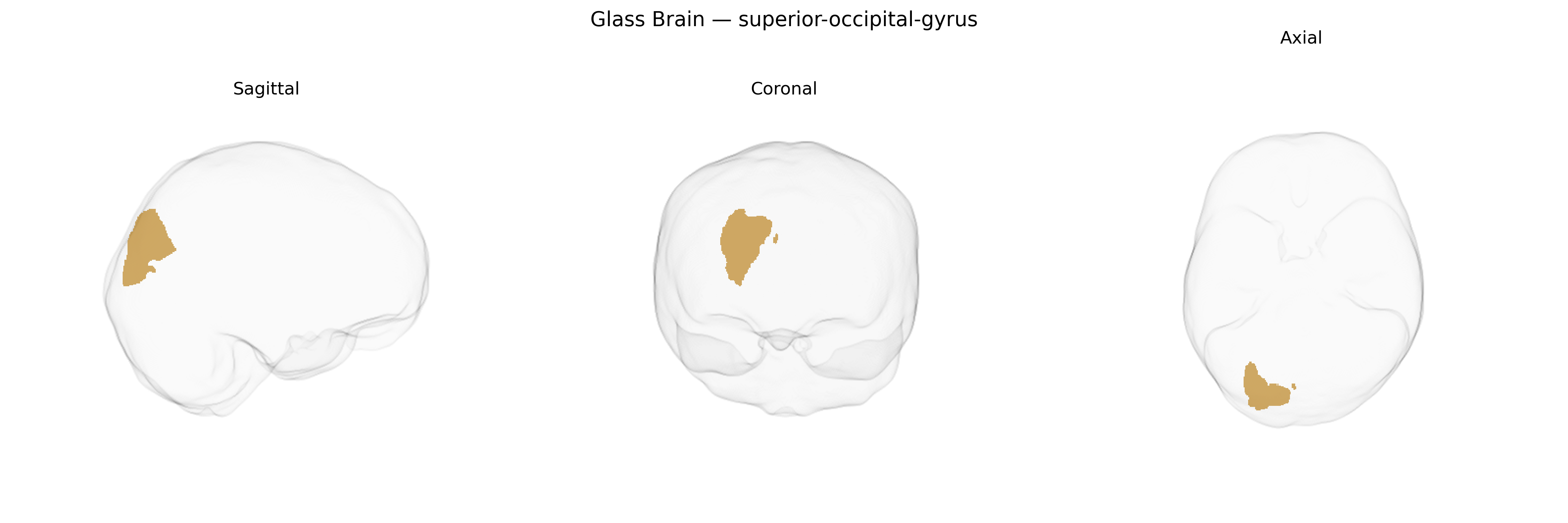 Triplanar Ghost Brain